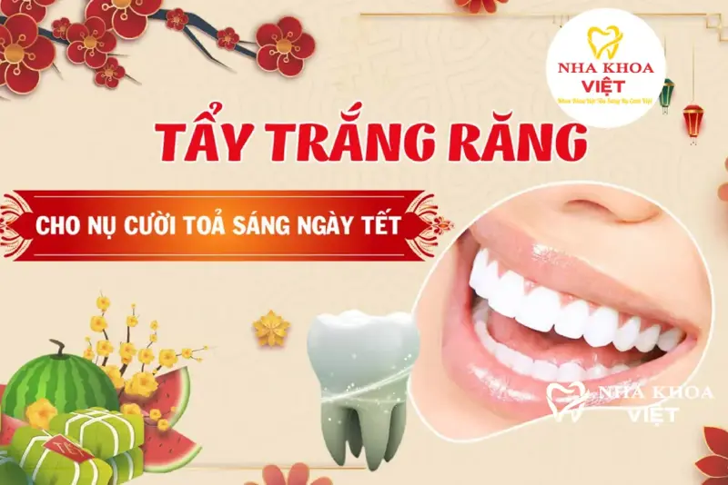 Chăm sóc răng hiệu quả - tẩy trắng răng trước dịp Tết
