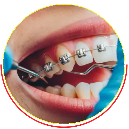 Nha khoa thẩm mỹ - Nha khoa Việt